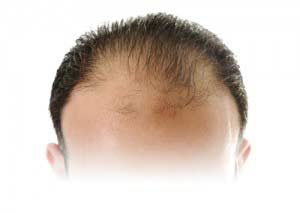 hair transplant clinic